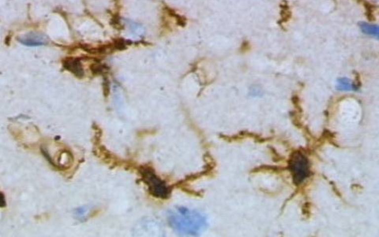 Microglia